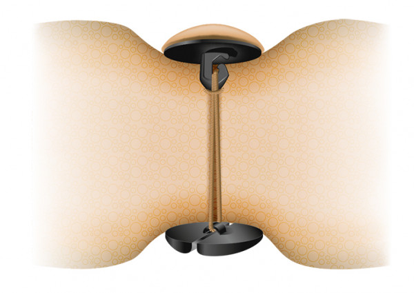 PHPF Polster Haken Plastikknopf